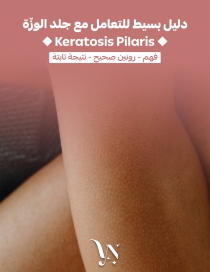 Keratosis pilaris - جلد الوزة